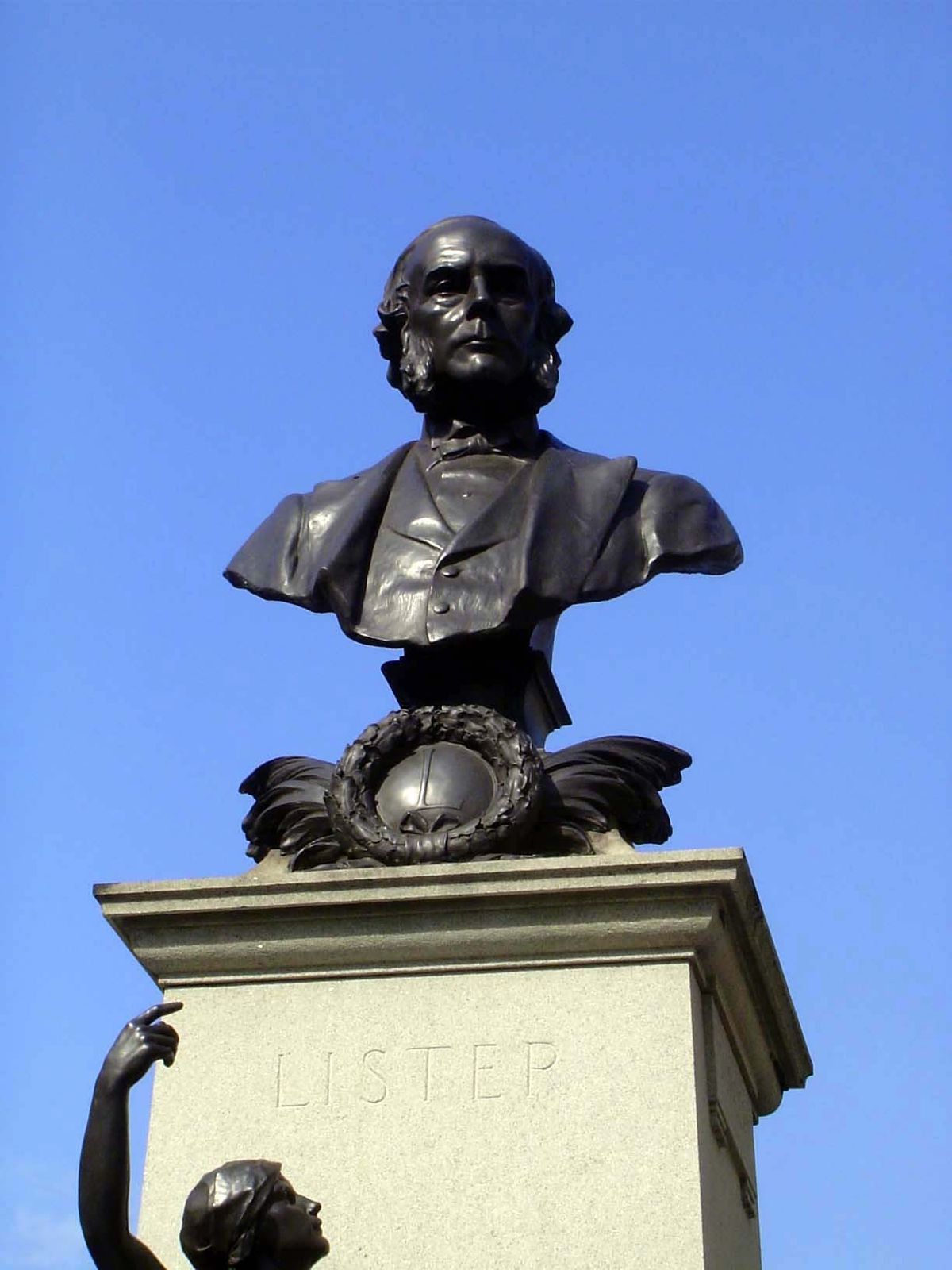 Joseph Lister, whose germ theory and use of carbolic acid in wounds dramatically reduced infection.